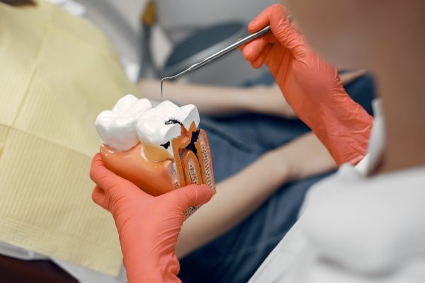 Síntomas y tratamiento de la Mucositis y periimplantitis