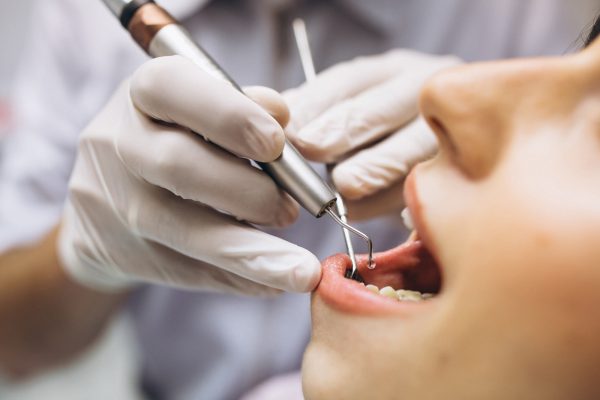 síntomas de rechazo de injerto de hueso dental