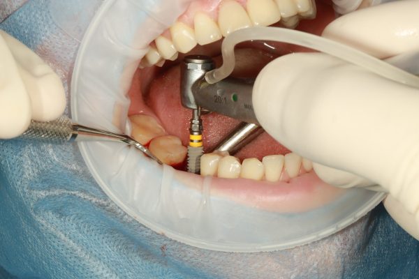 volodymyr007-dental-3754769